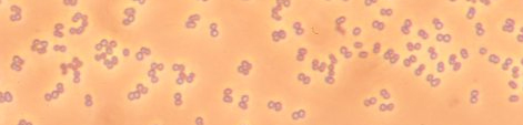 Lactic Acid Bacteria and Yeast